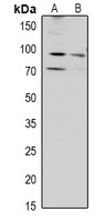 ZAK Rabbit Polyclonal Antibody