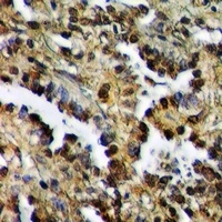 ZAK Rabbit Polyclonal Antibody