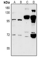 CLIC6 Rabbit Polyclonal Antibody