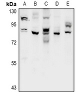 CSGLCAT Rabbit Polyclonal Antibody