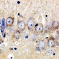 CSGLCAT Rabbit Polyclonal Antibody