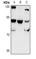 CHSY1 Rabbit Polyclonal Antibody