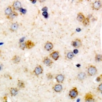 CHSY1 Rabbit Polyclonal Antibody