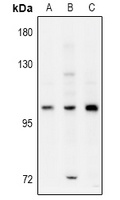 ELP2 Rabbit Polyclonal Antibody
