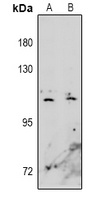 EPHA10 Rabbit Polyclonal Antibody