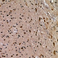FKBPL Rabbit Polyclonal Antibody