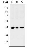 SIX1 Rabbit Polyclonal Antibody