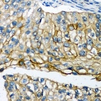 POTEG Rabbit Polyclonal Antibody