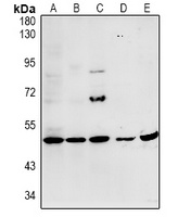 MYPT3 Rabbit Polyclonal Antibody