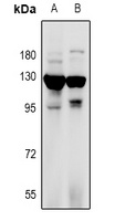 RANBP17 Rabbit Polyclonal Antibody