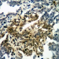 RANBP17 Rabbit Polyclonal Antibody
