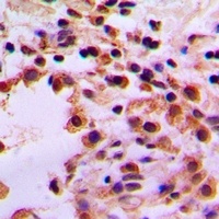 STK36 Rabbit Polyclonal Antibody