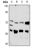 PLK3 Rabbit Polyclonal Antibody
