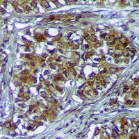 PLK3 Rabbit Polyclonal Antibody
