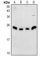 N4WBP5 Rabbit Polyclonal Antibody