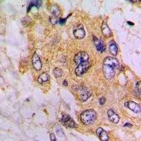 GNE Rabbit Polyclonal Antibody