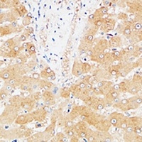 Hepassocin Rabbit Polyclonal Antibody