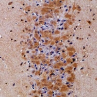 Prolyl Endopeptidase Rabbit Polyclonal Antibody