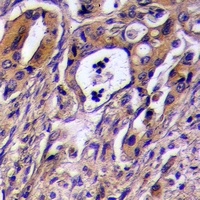CD97 alpha Rabbit Polyclonal Antibody