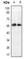 PALF Rabbit Polyclonal Antibody