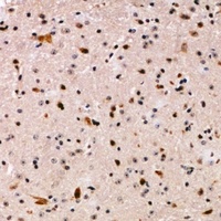 PALF Rabbit Polyclonal Antibody