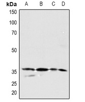 PDGFC Rabbit Polyclonal Antibody