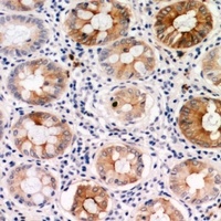 PDGFC Rabbit Polyclonal Antibody
