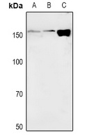 NAIP Rabbit Polyclonal Antibody