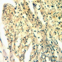 NAIP Rabbit Polyclonal Antibody