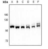Factor XIIIa Rabbit Polyclonal Antibody