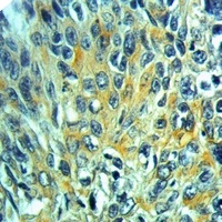 Factor XIIIa Rabbit Polyclonal Antibody