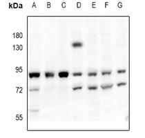PKC-pan Rabbit Polyclonal Antibody