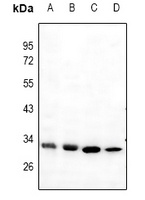 Mast Cell Tryptase Rabbit Polyclonal Antibody