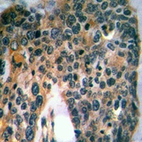 Mast Cell Tryptase Rabbit Polyclonal Antibody