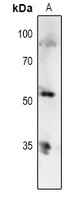 p53 (Phospho-T81) Rabbit Polyclonal Antibody