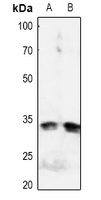 IGFBP3 (Phospho-S183) Rabbit Polyclonal Antibody