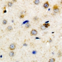 IGFBP3 (Phospho-S183) Rabbit Polyclonal Antibody