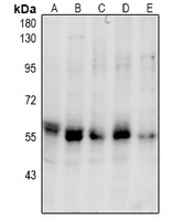 PINK1 (Phospho-S228) Rabbit Polyclonal Antibody