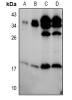 BIK (Phospho-S35) Rabbit Polyclonal Antibody