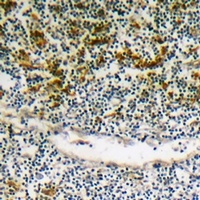 BIK (Phospho-S35) Rabbit Polyclonal Antibody