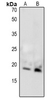 MBP (Phospho-T232) Rabbit Polyclonal Antibody