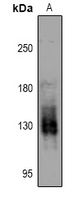 PKN1/2 (Phospho-T774/816) Rabbit Polyclonal Antibody