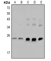 cTnI (Phospho-S23/S24) Rabbit Polyclonal Antibody