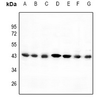 C/EBP alpha Rabbit Polyclonal Antibody
