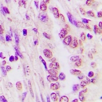 C/EBP alpha Rabbit Polyclonal Antibody
