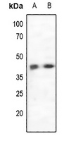 CCR5 Rabbit Polyclonal Antibody