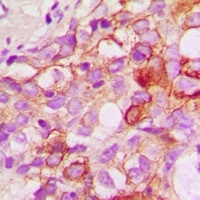 CRKL Rabbit Polyclonal Antibody