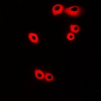CRKL Rabbit Polyclonal Antibody