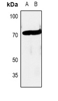 c-RAF Rabbit Polyclonal Antibody