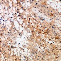 c-RAF Rabbit Polyclonal Antibody